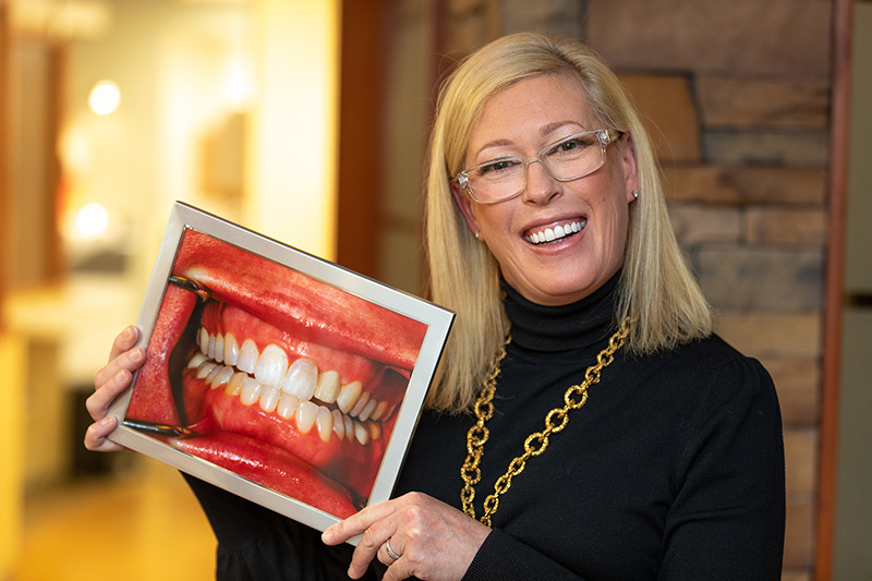 Georgia Dental Implants - Artistic Dentistry