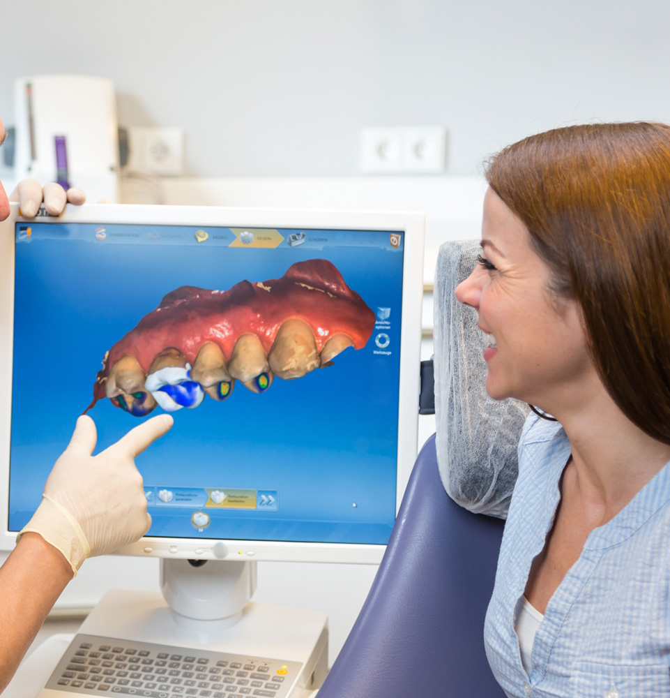 cerec3