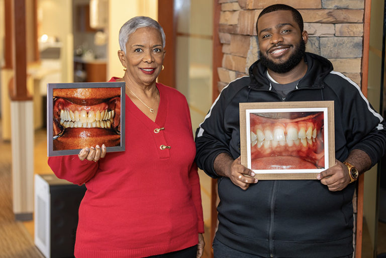 Porcelain Veneers Atlanta, GA Artistic Dentistry of Atlanta