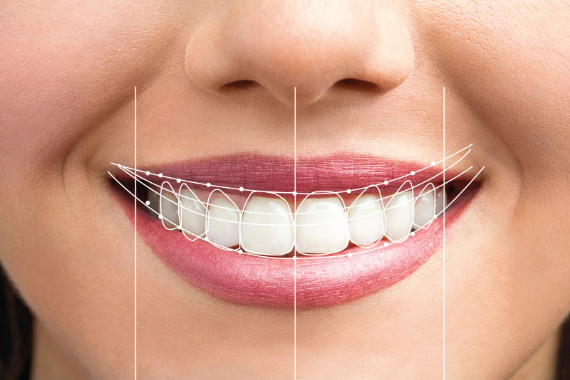 Atlanta Cosmetic Dentists