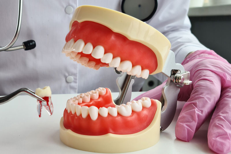 Why Would I Get Dental Implants After a Tooth Extraction?